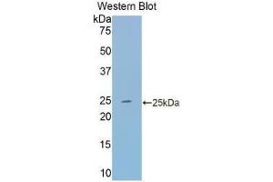 Western blot analysis of the recombinant protein. (Transferrin Antikörper  (AA 22-176))