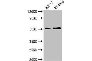 Western Blot Positive WB detected in: MCF-7 whole cell lysate, Mouse kidney tissue All lanes: GFRA1 antibody at 3 μg/mL Secondary Goat polyclonal to rabbit IgG at 1/50000 dilution Predicted band size: 52, 51 kDa Observed band size: 52 kDa (GFRA1 Antikörper  (AA 230-385))