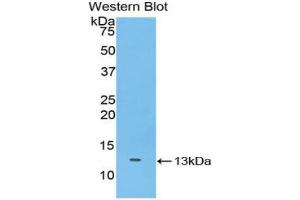 Western blot analysis of the recombinant protein. (SLIT3 Antikörper  (AA 453-516))