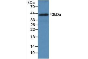 Detection of Recombinant HSPA1A, Human using Monoclonal Antibody to Heat Shock 70 kDa Protein 1A (HSPA1A) (HSP70 1A Antikörper  (AA 285-641))