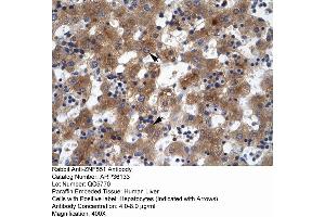 Human Liver (ZNF551 Antikörper  (N-Term))
