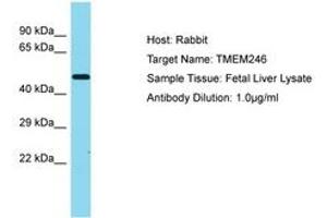 Image no. 1 for anti-Transmembrane Protein 246 (TMEM246) (AA 152-201) antibody (ABIN6750482) (TMEM246 Antikörper  (AA 152-201))