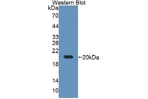 Detection of Recombinant DTYMK, Human using Polyclonal Antibody to Deoxythymidylate Kinase (DTYMK) (DTYMK Antikörper  (AA 43-190))