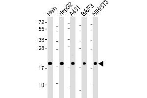 PPIB Antikörper  (AA 161-195)