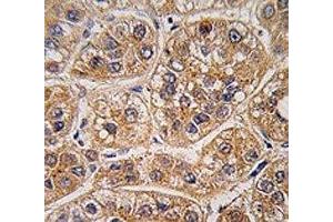 Immunohistochemistry (IHC) image for anti-Aldo-Keto Reductase Family 1, Member A1 (Aldehyde Reductase) (AKR1A1) (AA 293-325) antibody (ABIN3029900)