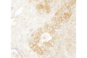Immunohistochemistry (IHC) image for anti-Catenin, beta (CATNB) (AA 760-781) antibody (ABIN7448432) (beta Catenin Antikörper  (AA 760-781))