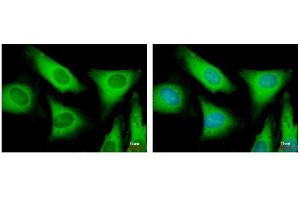 ICC/IF Image EIF2 beta antibody detects EIF2S2 protein at cytoplasm by immunofluorescent analysis.