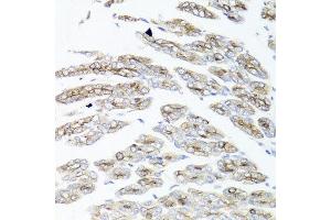 Immunohistochemistry of paraffin-embedded mouse stomach using IER3 antibody at dilution of 1:100 (x40 lens). (IER3 Antikörper)