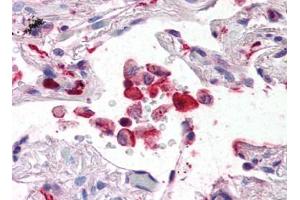 Image no. 1 for anti-Ionized Calcium-binding Adapter Molecule 1 (IBA1) (C-Term) antibody (ABIN492698) (Iba1 Antikörper  (C-Term))