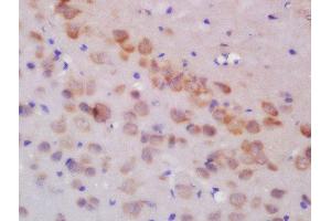 Formalin-fixed and paraffin embedded rat brain labeled with Rabbit Anti-GLUR3 Polyclonal Antibody, Unconjugated  at 1:200 followed by conjugation to the secondary antibody and DAB staining (Glutamate Receptor 3 Antikörper  (AA 451-550))