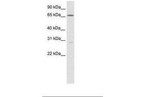 Image no. 1 for anti-Nuclear Factor of Activated T-Cells 5, Tonicity-Responsive (NFAT5) (C-Term) antibody (ABIN6736082) (NFAT5 Antikörper  (C-Term))