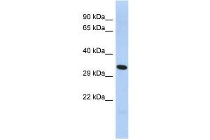 WB Suggested Anti-FOXK2 Antibody Titration:  0.