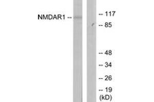 Western blot analysis of extracts from Jurkat cells, using NMDAR1 (Ab-897) Antibody. (GRIN1/NMDAR1 Antikörper  (AA 864-913))