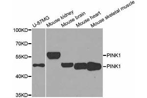 Western blot analysis of extracts of various cell lines, using PINK1 antibody (ABIN5974289) at 1/1000 dilution. (PINK1 Antikörper)