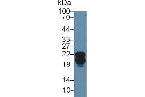 Western blot analysis of Human A549 cell lysate, using Rabbit Anti-Human CAV1 Antibody (2 µg/ml) and HRP-conjugated Goat Anti-Rabbit antibody (abx400043, 0. (Caveolin-1 Antikörper  (AA 2-104))