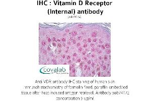 Image no. 1 for anti-Vitamin D Receptor (VDR) (Internal Region) antibody (ABIN1740731) (Vitamin D Receptor Antikörper  (Internal Region))