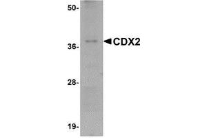 Western blot analysis of CDX2 in mouse brain tissue lysate with AP30223PU-N CDX2 antibody at 1 μg/ml. (CDX2 Antikörper  (C-Term))