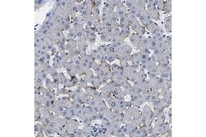 Immunohistochemical staining of human liver with CLEC4G polyclonal antibody  shows distinct positivity in sinusoids. (CLEC4G Antikörper)