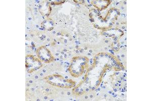 Immunohistochemistry of paraffin-embedded rat kidney using SYNPO antibody at dilution of 1:100 (x40 lens).
