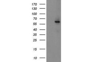 Western Blotting (WB) image for anti-Cytochrome P450, Family 2, Subfamily J, Polypeptide 2 (CYP2J2) antibody (ABIN1497730) (CYP2J2 Antikörper)