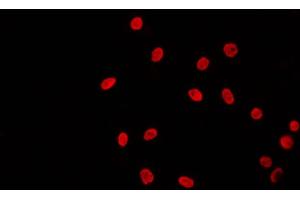 ABIN6269020 staining 293 by IF/ICC. (TBP Antikörper  (N-Term))