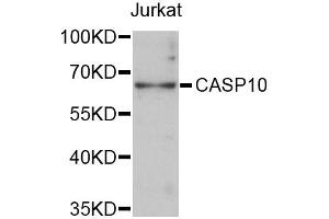 Western blot analysis of extracts of Jurkat cells, using CASP10 antibody (ABIN1871452) at 1:3000 dilution. (Caspase 10 Antikörper)
