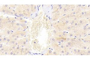 Detection of DR5 in Human Liver Tissue using Polyclonal Antibody to Death receptor 5 (DR5) (TNFRSF10B Antikörper  (AA 234-435))