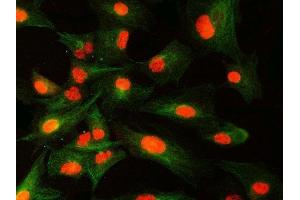 IF analysis of SNRNP40 and Tubulin beta using anti-SNRNP40 antibody (ABIN7601719) and anti-Tubulin beta antibody (ABIN7602744). (SNRNP40 Antikörper  (AA 43-357))