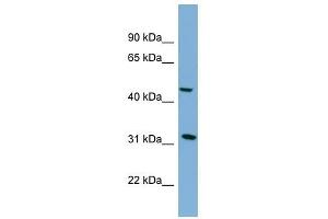 SERPINI2 antibody used at 1 ug/ml to detect target protein.