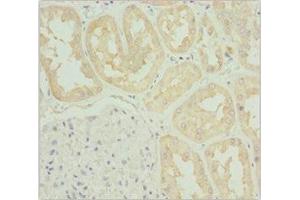 Immunohistochemistry of paraffin-embedded human kidney tissue using ABIN7171763 at dilution of 1:100 (TNS3 Antikörper  (AA 1-240))