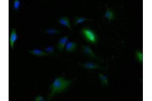 Immunofluorescence staining of U251 cells with ABIN7147821 at 1:150, counter-stained with DAPI. (Clarin 2 Antikörper  (AA 31-100))