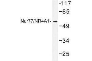 Image no. 1 for anti-Nuclear Receptor Subfamily 4, Group A, Member 1 (NR4A1) antibody (ABIN317895) (NR4A1 Antikörper)