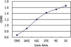 S100A8 (Human) Matched Antibody Pair