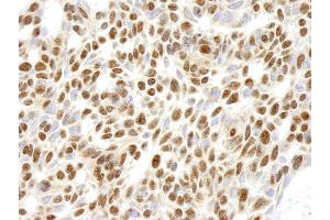 Immunohistochemistry (IHC) image for anti-Ribosomal Protein L26 (RPL26) (C-Term) antibody (ABIN7448782)