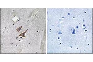 Immunohistochemistry analysis of paraffin-embedded human brain, using TSC2 (Phospho-Tyr1571) Antibody. (Tuberin Antikörper  (pTyr1571))