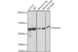 Western blot analysis of extracts of various cell lines, using Desmin Rabbit mAb (ABIN1678733, ABIN3018020, ABIN3018021 and ABIN7101569) at 1:1000 dilution. (Desmin Antikörper)