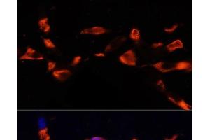 Immunofluorescence analysis of NIH/3T3 cells using MCTS1 Polyclonal Antibody at dilution of 1:100 (40x lens).