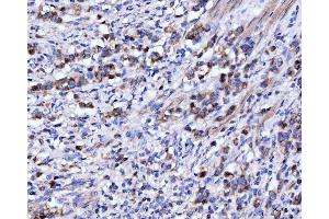 IHC analysis of DHODH using anti-DHODH antibody (ABIN7603139). (DHODH Antikörper  (N-Term))