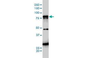 JUP monoclonal antibody (M01A), clone 1D5 Western Blot analysis of JUP expression in A-431 . (JUP Antikörper  (AA 1-745))