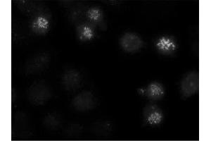 Image no. 1 for anti-Centromere Protein E, 312kDa (CENPE) antibody (ABIN341075) (CENPE Antikörper)