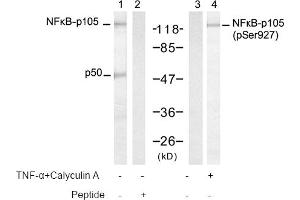 Image no. 1 for anti-Nuclear Factor of kappa Light Polypeptide Gene Enhancer in B-Cells 1 (NFKB1) (pSer927) antibody (ABIN319253) (NFKB1 Antikörper  (pSer927))