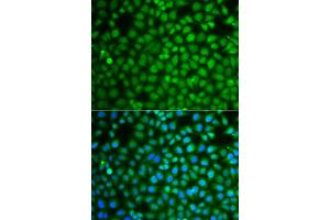 Immunofluorescence analysis of A549 cells using ZNF346 antibody (ABIN5975303). (ZNF346 Antikörper)