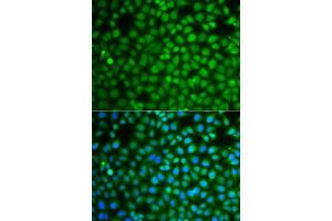 Immunofluorescence analysis of A549 cells using ZNF346 antibody (ABIN5975303). (ZNF346 Antikörper)