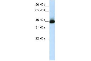 WB Suggested Anti-GSH2 Antibody Titration:  1. (GSX2 Antikörper  (C-Term))