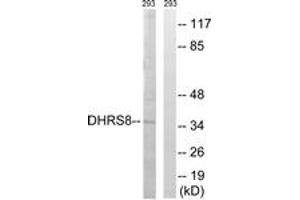 Western Blotting (WB) image for anti-Hydroxysteroid (17-Beta) Dehydrogenase 11 (HSD17B11) (AA 71-120) antibody (ABIN2890258) (HSD17B11 Antikörper  (AA 71-120))
