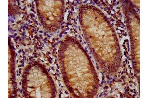 IHC image of ABIN7159682 diluted at 1:700 and staining in paraffin-embedded human appendix tissue performed on a Leica BondTM system. (RFX1 Antikörper  (AA 36-133))