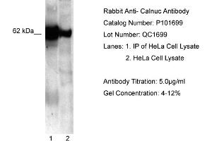 WB Suggested Anti-NUCB1  Antibody Titration: 5.
