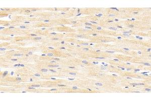 Detection of ANGPTL4 in Rat Cardiac Muscle Tissue using Polyclonal Antibody to Angiopoietin Like Protein 4 (ANGPTL4) (ANGPTL4 Antikörper  (AA 182-394))