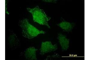 Image no. 5 for anti-EH-Domain Containing 3 (EHD3) (AA 357-407) antibody (ABIN599233) (EHD3 Antikörper  (AA 357-407))