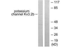 Western blot analysis of extracts from HepG2 cells, using Potassium Channel Kv3. (KCNC2 Antikörper)